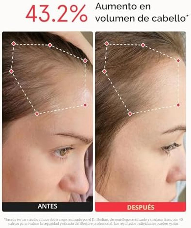 iRestore Sistema profesional de terapia láser de luz roja iRestore para el crecimiento del cabello - Autorizado por la FDA para el tratamiento de la pérdida de cabello, adelgazamiento del cabello y alopecia