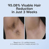 Depiladora IPL INNZA con cuidado de enfriamiento. 999,999 flashes y resultados duraderos, eliminador de vello sin dolor para mujeres