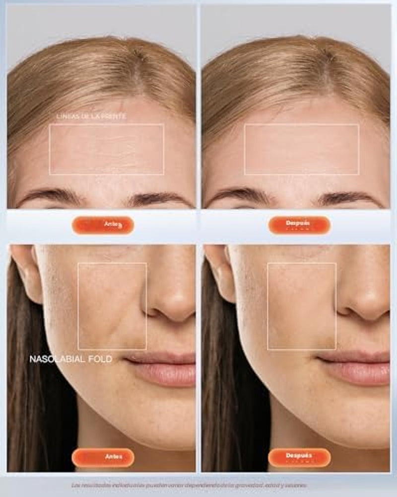 NEWKEY Sistema de terapia de fotones Newkey de luz LED, en 7 colores, para el cuidado de la piel facial y máscara de belleza