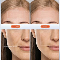 NEWKEY Sistema de terapia de fotones Newkey de luz LED, en 7 colores, para el cuidado de la piel facial y máscara de belleza