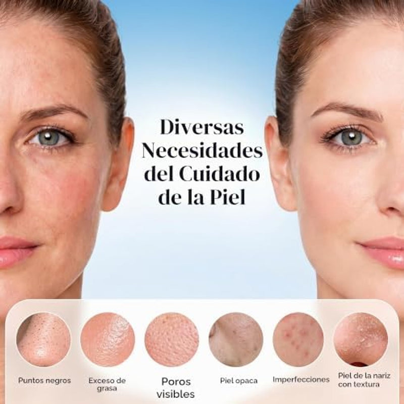 GUGUG - Limpiador de poros facial 4 en 1 impermeable para la piel