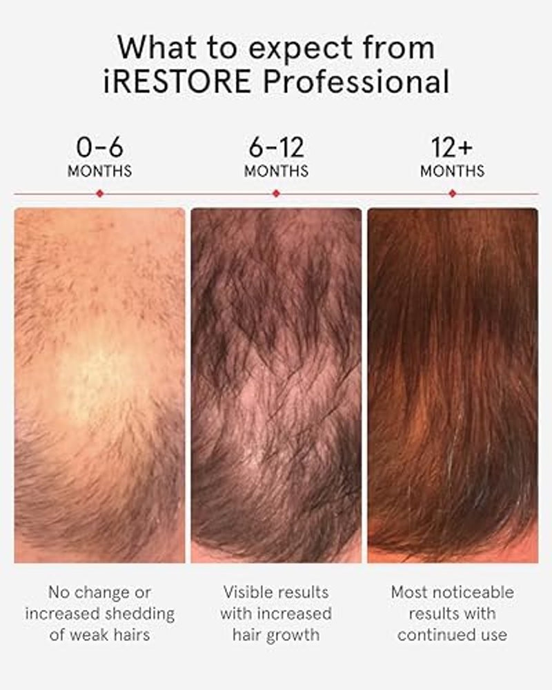 iRestore Sistema profesional de terapia láser de luz roja iRestore para el crecimiento del cabello - Autorizado por la FDA para el tratamiento de la pérdida de cabello, adelgazamiento del cabello y alopecia