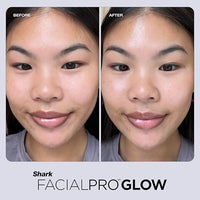 Shark FacialPro Glow at-Home Hydro-Powered Facial System with DePuffi Hot & Cold Therapy – Professional Spa Skincare Device for Pore Cleansing, Hydration, & Radiant Glow, Lilac, FH320PL