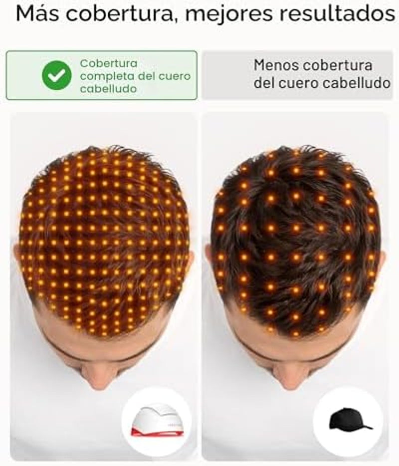 iRestore Sistema profesional de terapia láser de luz roja iRestore para el crecimiento del cabello - Autorizado por la FDA para el tratamiento de la pérdida de cabello, adelgazamiento del cabello y alopecia