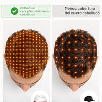 iRestore Sistema profesional de terapia láser de luz roja iRestore para el crecimiento del cabello - Autorizado por la FDA para el tratamiento de la pérdida de cabello, adelgazamiento del cabello y alopecia
