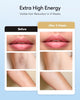 INNZA IPL Hair Removal with Ice Cooling Care Function for Women Permanent,999,999 Flashes Painless IPL Hair Remover, Hair Removal Device for Armpits Legs Arms Bikini Line