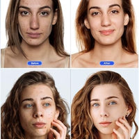 NEWKEY Sistema de terapia de fotones Newkey de luz LED, en 7 colores, para el cuidado de la piel facial y máscara de belleza