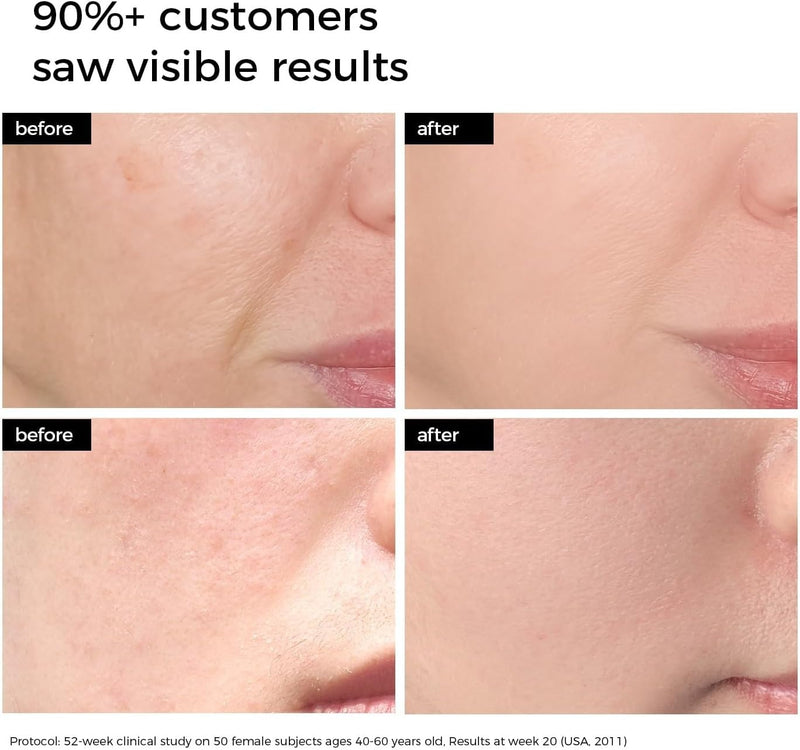 Suero facial hidratante con ácido hialurónico WNP al 3% para piel seca, 100 unidades.