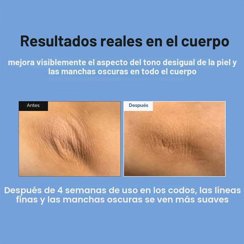 MEDITHERAPY Retinal Skin Booster Serum - Retinaldehído no irritante para principiantes para cara y cuerpo - Minimizador de poros de retinol antienvejecimiento para piel propensa a imperfecciones
