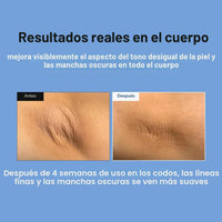 MEDITHERAPY Retinal Skin Booster Serum - Retinaldehído no irritante para principiantes para cara y cuerpo - Minimizador de poros de retinol antienvejecimiento para piel propensa a imperfecciones