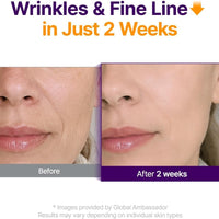 PURITO Retinol 0.1% + Retinal 0.1% Suero facial antienvejecimiento