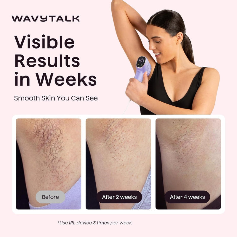 Wavytalk Dispositivo de depilación IPL, Bare It con rodillo de precisión para bikini facial y cuerpo, resultado duradero y sin dolor, 24J de doble pulso y enfriamiento de hielo, uso en casa para mujer