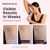 Wavytalk Dispositivo de depilación IPL, Bare It con rodillo de precisión para bikini facial y cuerpo, resultado duradero y sin dolor, 24J de doble pulso y enfriamiento de hielo, uso en casa para mujer