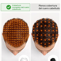 iRestore Professional - Sistema Láser de Crecimiento Capilar con 282 LEDs