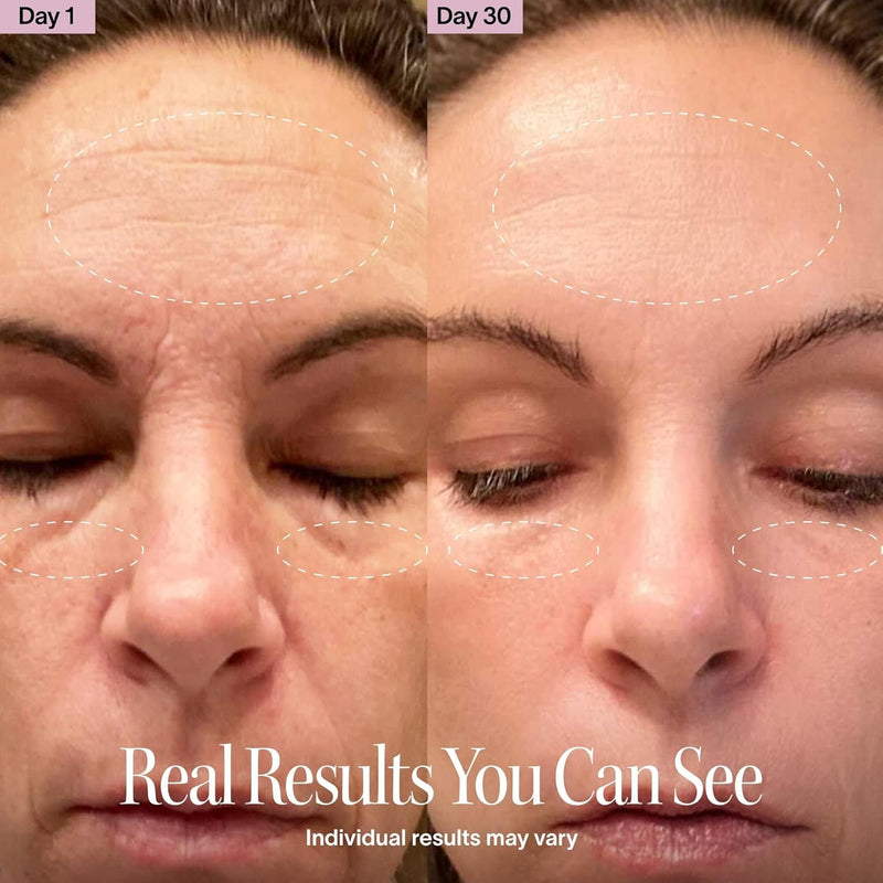 Solawave Varita de Terapia de Luz Roja 4 en 1 para Cara y Cuello