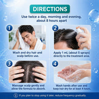🌿✨ Fortalece tu cabello desde la raíz con Minoxidil + Romero Hair Regrowth Treatment