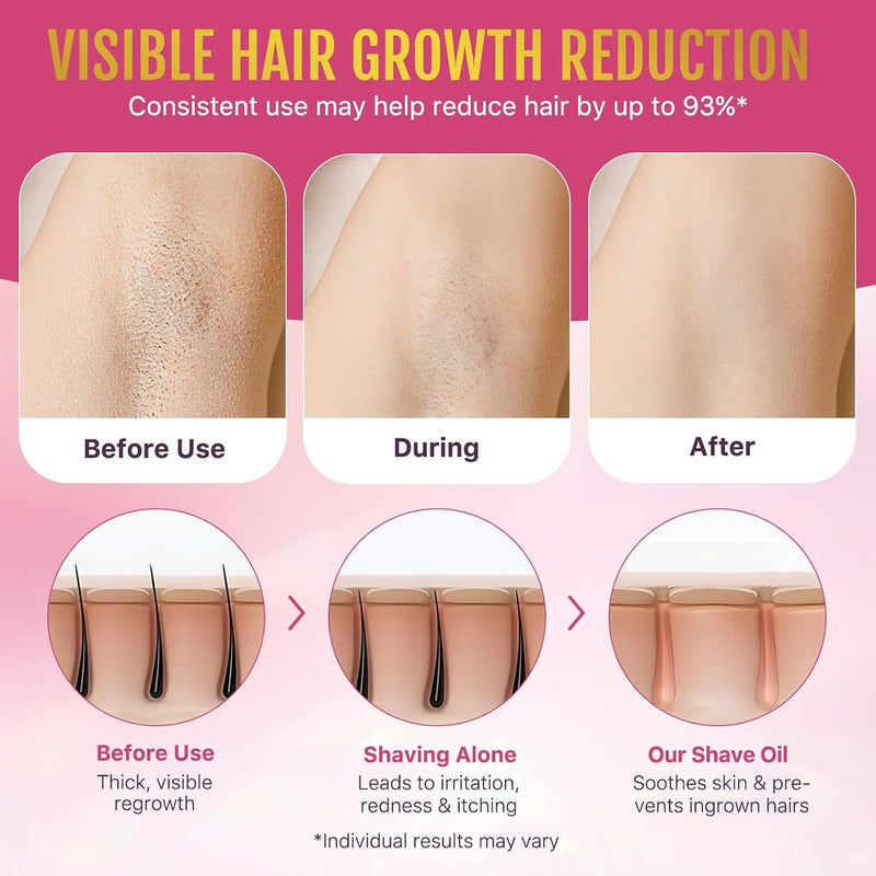 ikini Line Oil for Women - Smooth Glow After Shave Oil & Ingrown Hair Treatment | Razor Bumps, Strawberry Legs & Post Wax Care, Body Oil with Peptides & Strawberry AHA, 1.69 fl oz