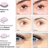 grace & stella - Mascarilla para debajo de los ojos galardonada - Regalos para mujeres - Regalos para niñas adolescentes - Parches de gel para ojeras, ojos hinchados, bolsas debajo de los ojos