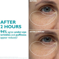 Peter Thomas Roth | Peptide Skinjection™  Infused Face & Eye Tape |