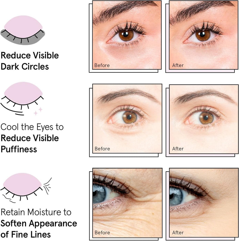 grace & stella Parches para debajo de los ojos (12 pares) Mascarillas para ojos hinchados y ojeras - Rellenos navideños para adolescentes, regalos de Navidad para mujeres, regalos de intercambio
