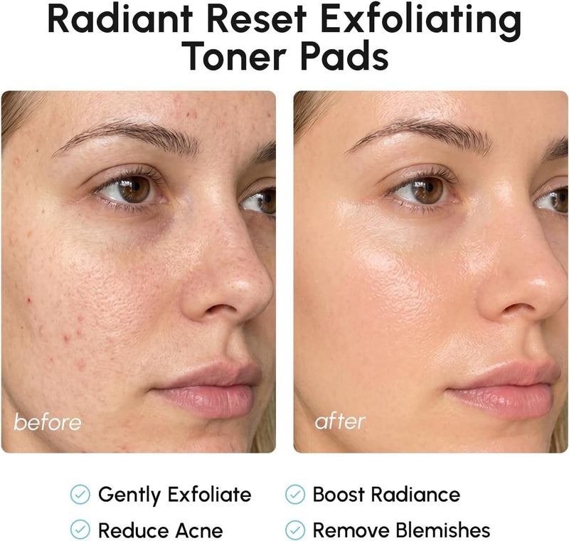 MAREE Almohadillas de ácido glicólico - Discos tonificantes para la limpieza facial - Disco exfoliante con aceite de árbol de té, ácido salicílico y vitaminas E, B3, B5 - Aparato para aclarar el acné