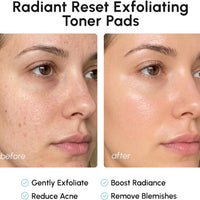 MAREE Almohadillas de ácido glicólico - Discos tonificantes para la limpieza facial - Disco exfoliante con aceite de árbol de té, ácido salicílico y vitaminas E, B3, B5 - Aparato para aclarar el acné