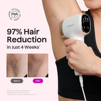 Wavytalk Dispositivo de depilación IPL, Bare It con rodillo de precisión para bikini facial y cuerpo – Larga duración e indoloro, 24J de doble pulso y enfriamiento de hielo, uso en casa para mujeres y