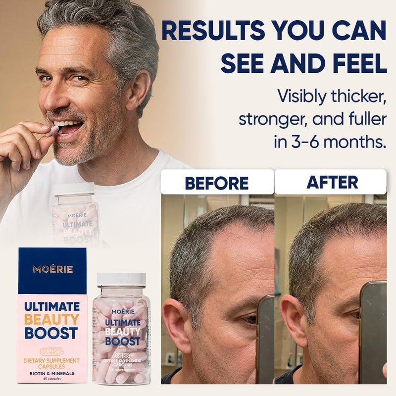 Moerie Ultimate Hair Boost Suplemento para Mujeres y Hombres – Vitaminas para el cabello, la piel y las uñas con biotina y minerales para la salud del cabello – Cabello más grueso – 60 cápsulas