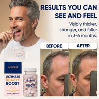 Moerie Ultimate Hair Boost Suplemento para Mujeres y Hombres – Vitaminas para el cabello, la piel y las uñas con biotina y minerales para la salud del cabello – Cabello más grueso – 60 cápsulas
