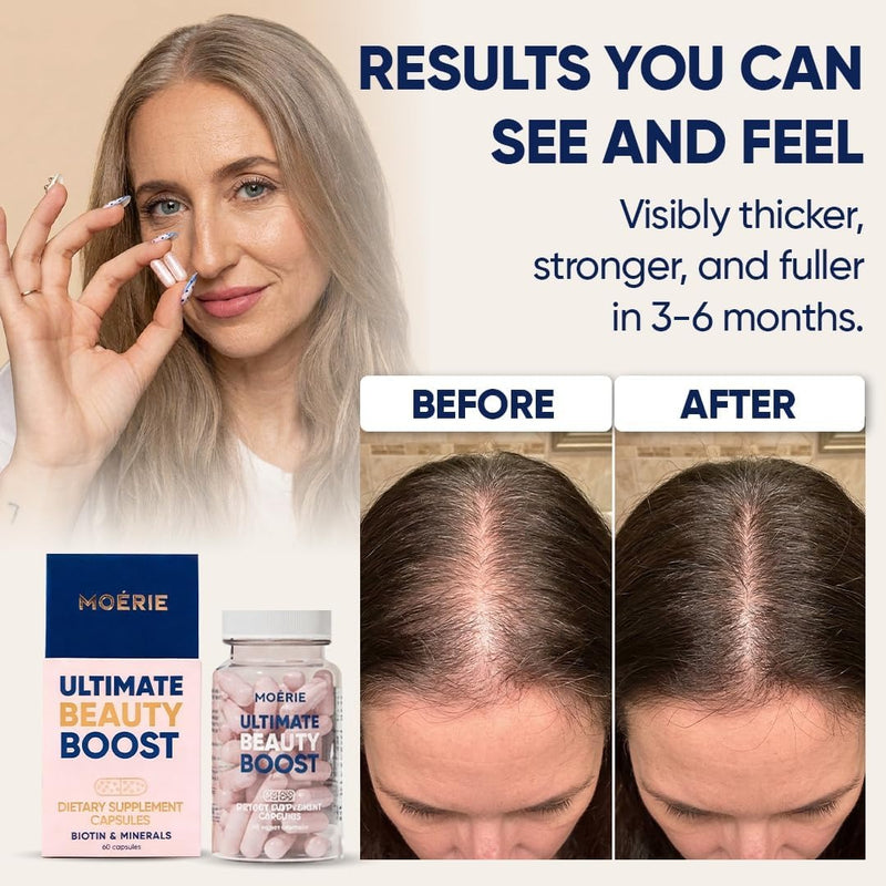Moerie Ultimate Hair Boost Suplemento para Mujeres y Hombres – Vitaminas para el cabello, la piel y las uñas con biotina y minerales para la salud del cabello – Cabello más grueso – 60 cápsulas