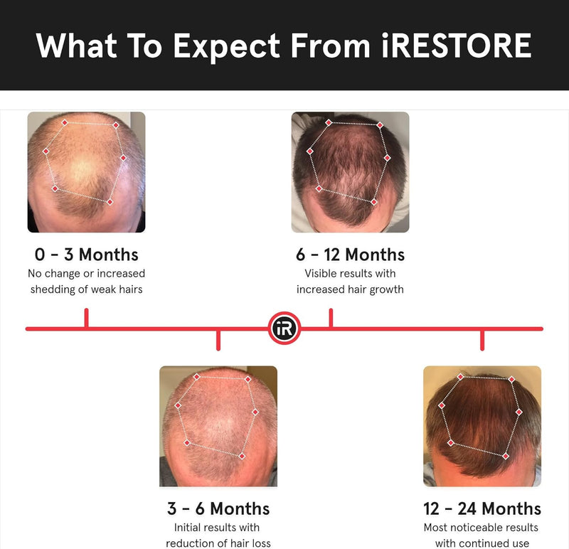 iRestore Sistema de crecimiento del cabello con láser esencial: tratamientos de pérdida de cabello aprobados por la FDA para hombres y mujeres y productos para el crecimiento del cabello para hombres