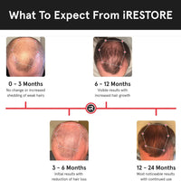 iRestore Sistema de crecimiento del cabello con láser esencial: tratamientos de pérdida de cabello aprobados por la FDA para hombres y mujeres y productos para el crecimiento del cabello para hombres