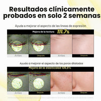 K-SECRET SEOUL 1988 Suero de Retinal – Formulado con Liposoma de Retinal Avanzado 2% y Extracto de Ginseng Negro 58%
