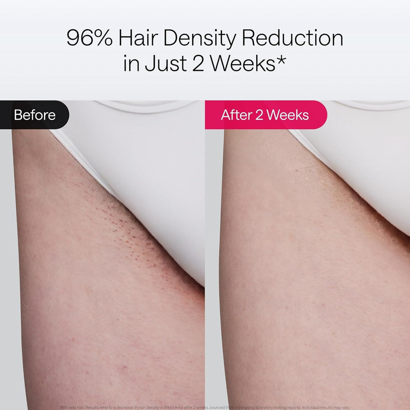 Ulike Depilación Láser Air 10 Versión Deluxe IPL para Mujeres y Hombres con Tecnología de Enfriamiento por Hielo, Reducción de Cabello Casi Indolora y Permanente, Depilación en Casa en 10 Minutos con