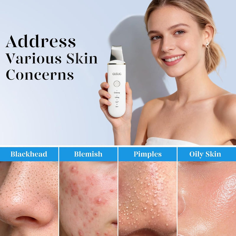 GUGUG - Espátula para exfoliar la piel, espátula facial, limpiador de poros, herramientas removedoras de puntos negros con 4 modos para limpieza profunda facial - Blanco