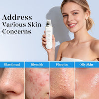 GUGUG - Espátula para exfoliar la piel, espátula facial, limpiador de poros, herramientas removedoras de puntos negros con 4 modos para limpieza profunda facial - Blanco