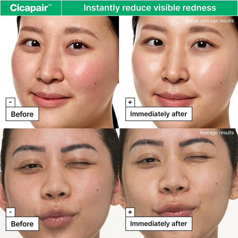Dr.Jart+ Cicapair Sensitive Skin Korean Face Moisturizer for Redness and Barrier Repair with Centella Asiatica