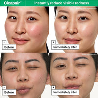 Dr.Jart+ Cicapair Sensitive Skin Korean Face Moisturizer for Redness and Barrier Repair with Centella Asiatica