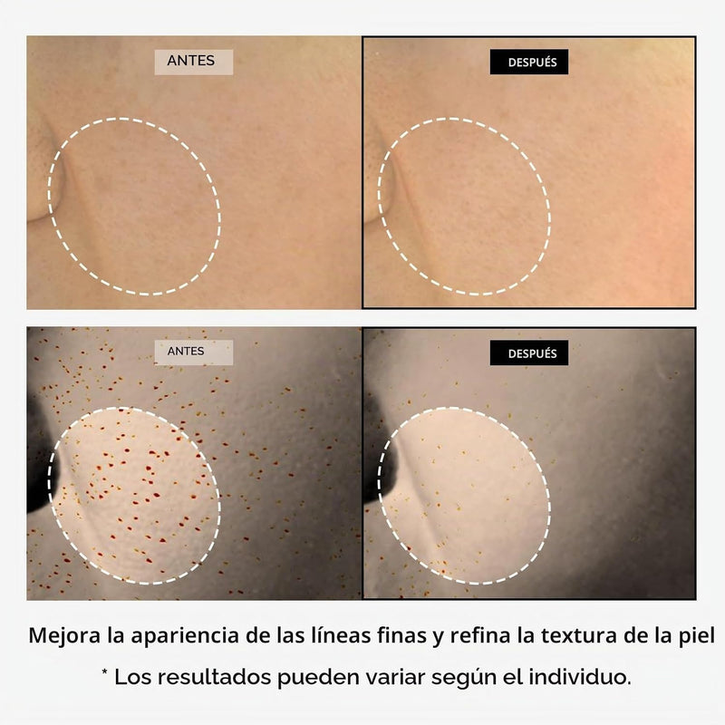 ✨ Reafirma y recupera la juventud de tu piel con TOSOWOONG Copper Peptide 12 Cream