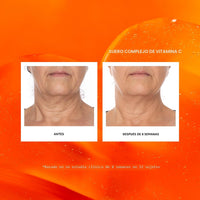 Naturium Suero Facial Complejo de Vitamina C con Acido Hialuronico y Vitamina E, Tratamiento Antienvejecimiento, 30ml