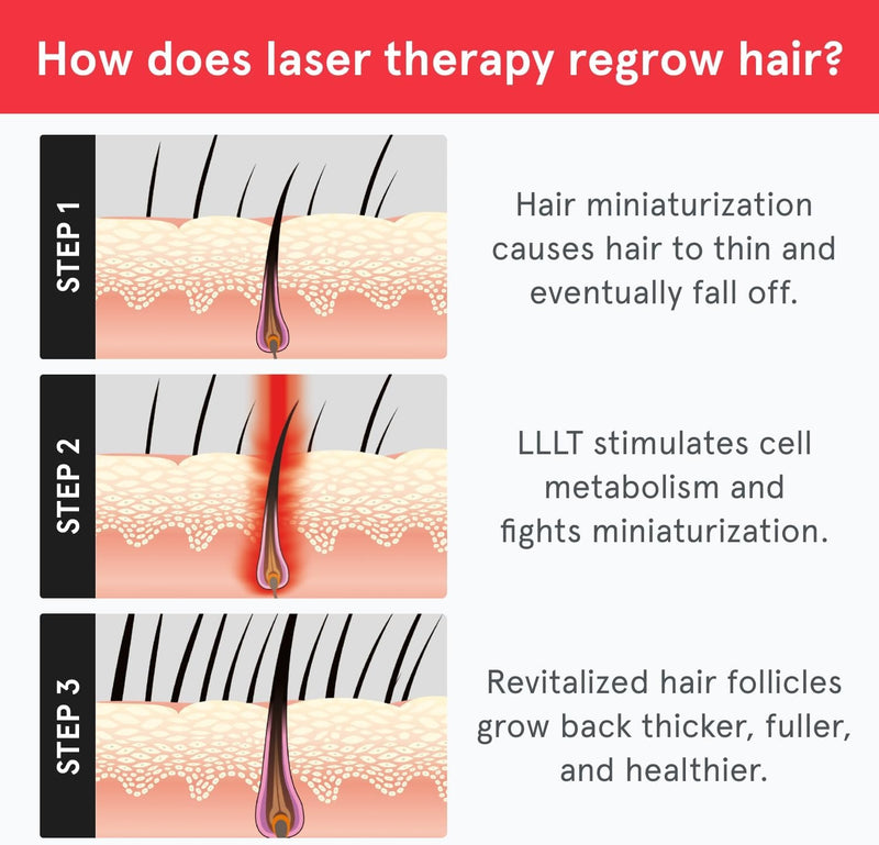 iRestore Sistema de crecimiento del cabello con láser esencial: tratamientos de pérdida de cabello aprobados por la FDA para hombres y mujeres y productos para el crecimiento del cabello para hombres