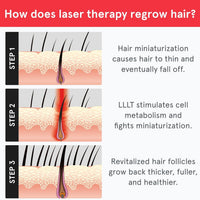 iRestore Sistema de crecimiento del cabello con láser esencial: tratamientos de pérdida de cabello aprobados por la FDA para hombres y mujeres y productos para el crecimiento del cabello para hombres