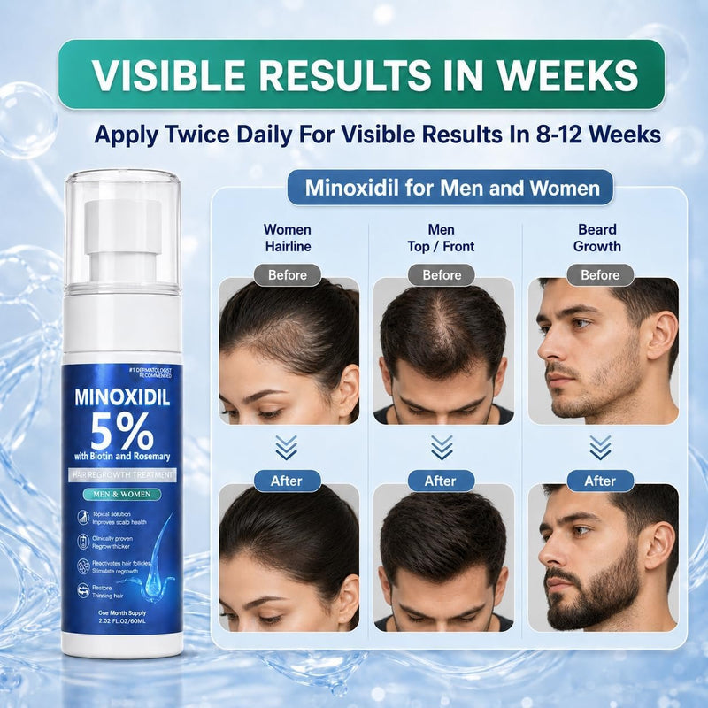 🌿✨ Fortalece tu cabello desde la raíz con Minoxidil + Romero Hair Regrowth Treatment