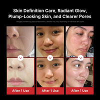 Medicube Age-R Booster Pro - Dispositivo Coreano 6 en 1, Glass Skin, EMS, LED, Masajeador Facial