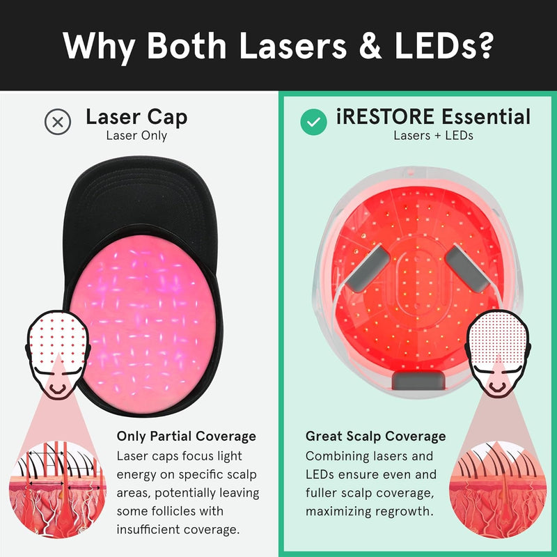 iRestore Sistema de crecimiento del cabello con láser esencial: tratamientos de pérdida de cabello aprobados por la FDA para hombres y mujeres y productos para el crecimiento del cabello para hombres