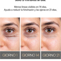 INIA Terapia de luz roja debajo de los ojos para la cara, dispositivo de belleza 4 en 1 con calor, vibración, masaje y luz roja para ojeras, hinchazón y reafirmación de la piel, mejora la rutina de