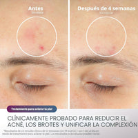 Mascarilla facial LED Shark CryoGlow con enfriamiento ocular, antienvejecimiento y reparación de imperfecciones, USB-C y control remoto
