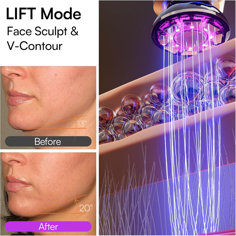 INIA Flare - Dispositivo facial de microcorriente 3 en 1, terapia de luz roja para cara y cuello, herramienta de masajeador con calor y vibración para el cuidado de la piel, hinchazón, reafirmación