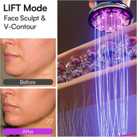 INIA Flare - Dispositivo facial de microcorriente 3 en 1, terapia de luz roja para cara y cuello, herramienta de masajeador con calor y vibración para el cuidado de la piel, hinchazón, reafirmación