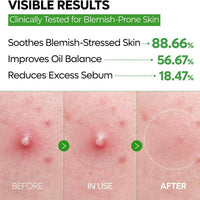 Dr.Melaxin S-ZINC ZERO-FIT Ultra Thin Blemish Spot Patch 0.013mm Invisible Pimple Stickers with Sulfur, Salicylic Acid, AHA & PHA, Seamless Under Makeup Face Cover, 12mm x 72 Patches
